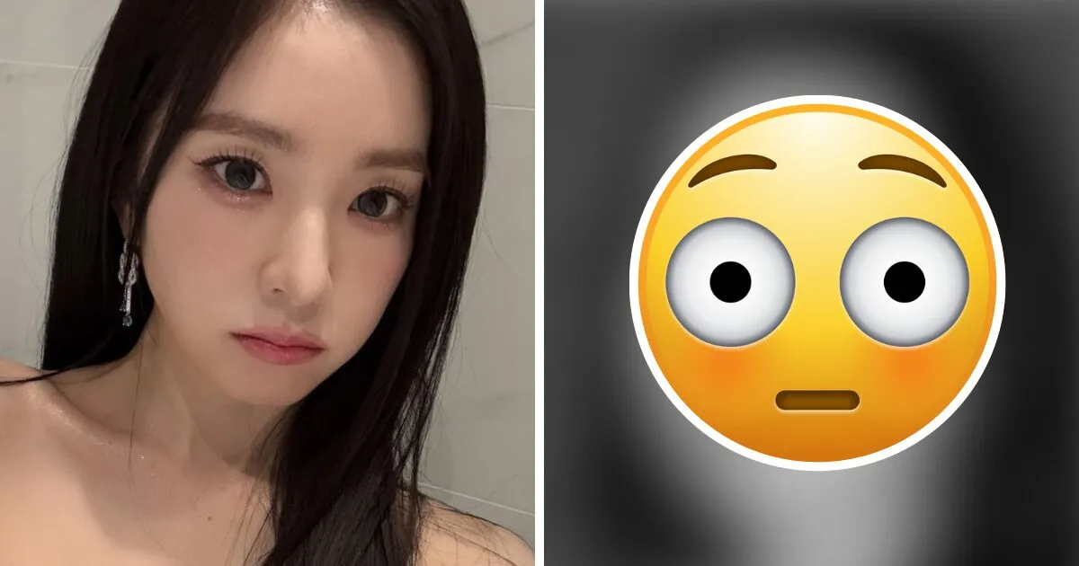 Red Velvet Irene’s Exposed “Real” Skin Condition Triggers Intense Reactions